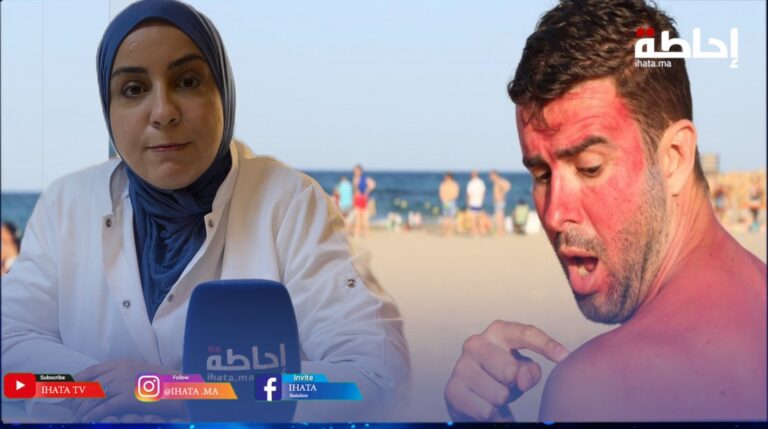 موسم الصيف.. الدكتورة أعماروش تقدم نصائح ذهبية للحفاظ على البشرة من حروق الشمس (فيديو)