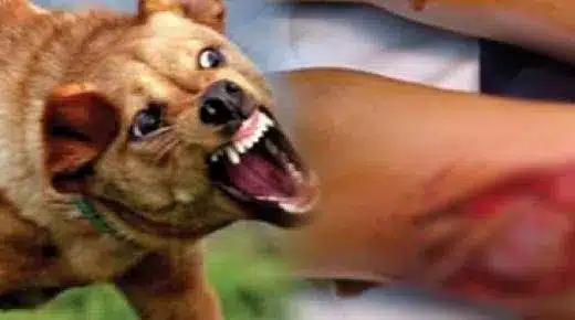 عضة كلب مسعور تُنهي حياة ثلاثيني بأكادير