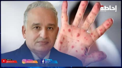 حمضي يحذر من تفشي "بوحمرون" ويدعو إلى فتح تحقيق