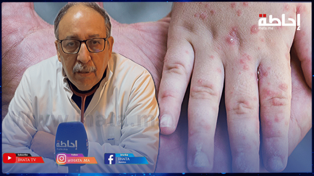 بوحمرون.. الدكتور عفيف يشخص الحالة الوبائية بالمغرب ويفند مزاعم خطورة اللقاح (فيديو)