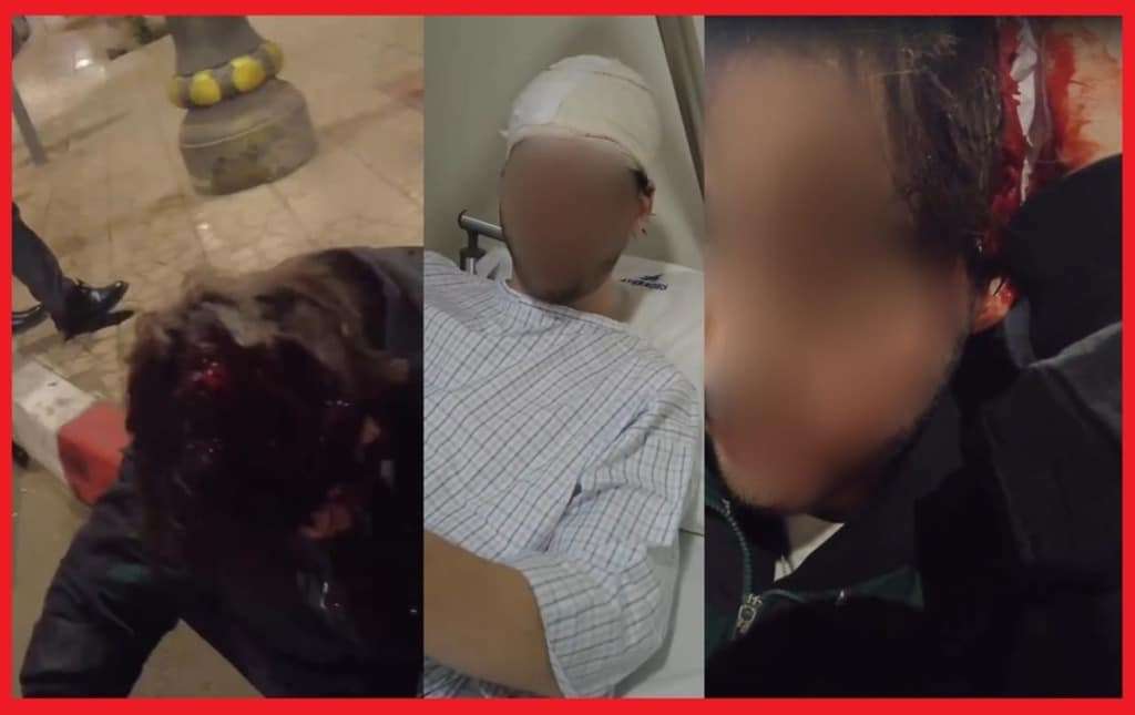 أمن مراكش يفُك لغز ظهور سائح أجنبي يحمل جرحا خطيرا على مستوى الرأس