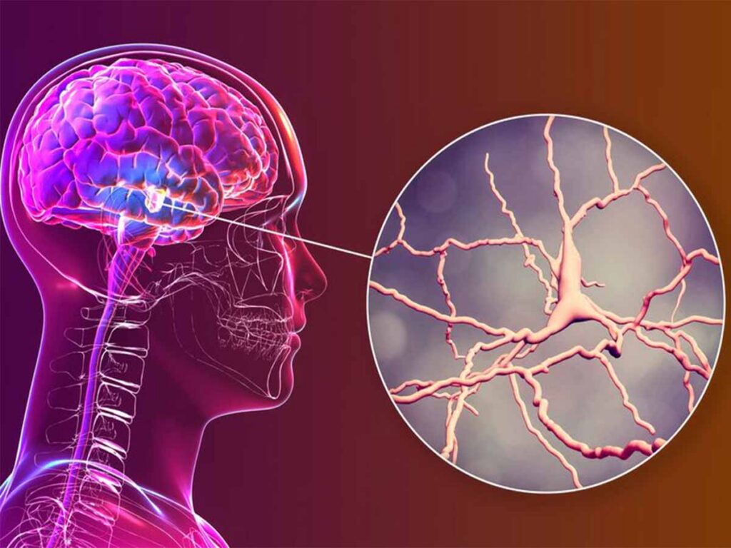 علماء أمريكيون يطورون غرسة دماغية تخفف الألم المزمن